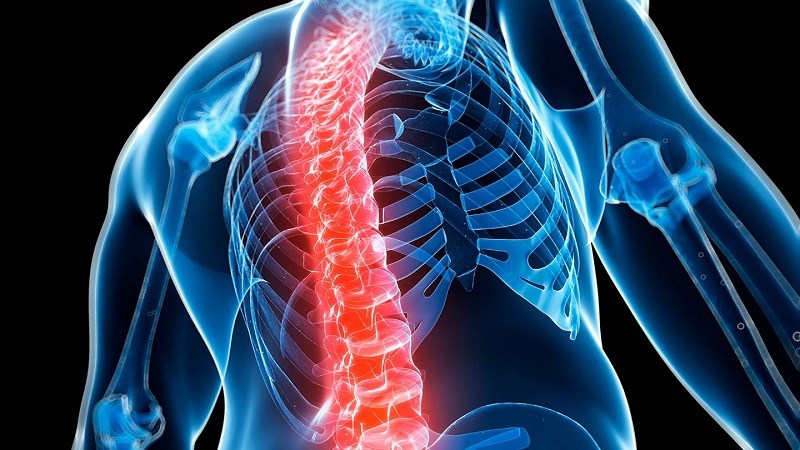 Tra-trang-la-gi-tac-dung-tuyet-voi-cua-tra-trang-den-suc-khoe-7