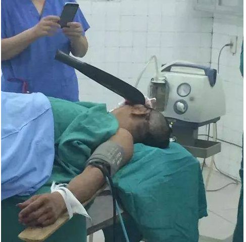 rửa bát bẩn phi dao vào đầu chồng