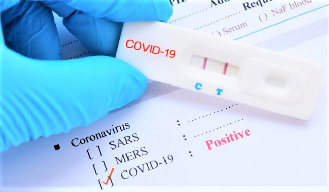 Chuyên gia chỉ 6 bước cần làm đúng khi test nhanh Covid tại nhà